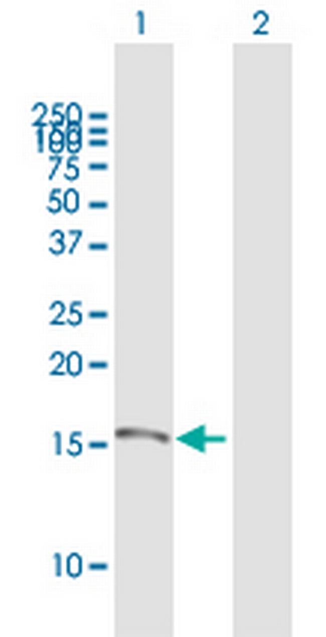 KISS1 Antibody in Western Blot (WB)