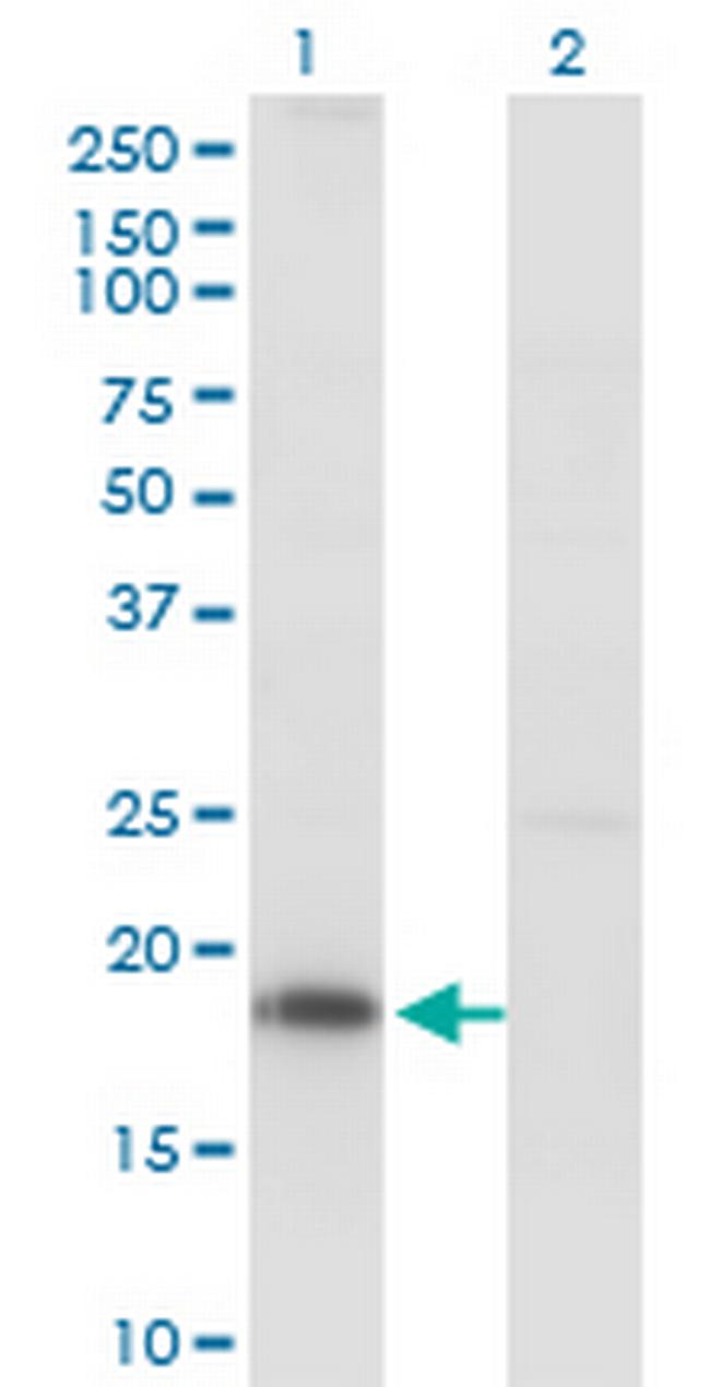 KISS1 Antibody in Western Blot (WB)