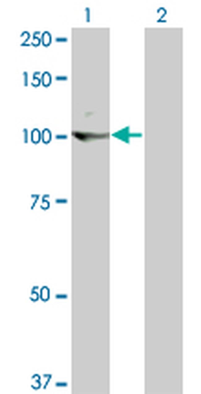 KIT Antibody in Western Blot (WB)