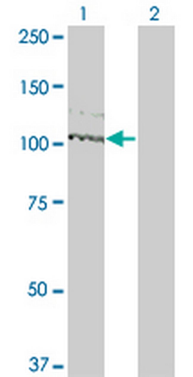 KIT Antibody in Western Blot (WB)