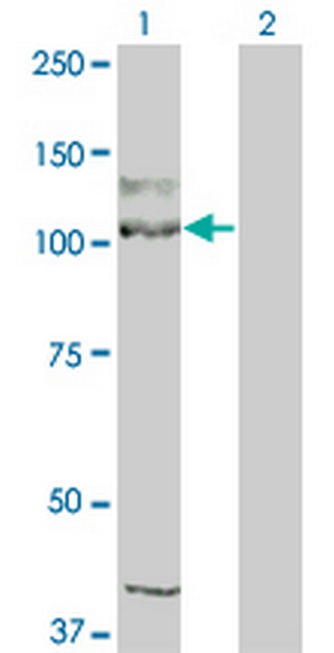 KIT Antibody in Western Blot (WB)