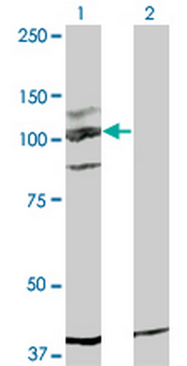 KIT Antibody in Western Blot (WB)