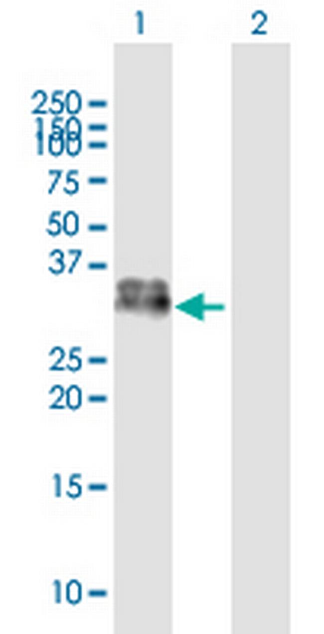 KLK1 Antibody in Western Blot (WB)