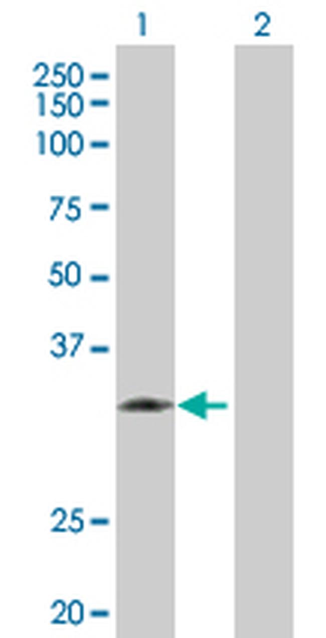 KLK1 Antibody in Western Blot (WB)