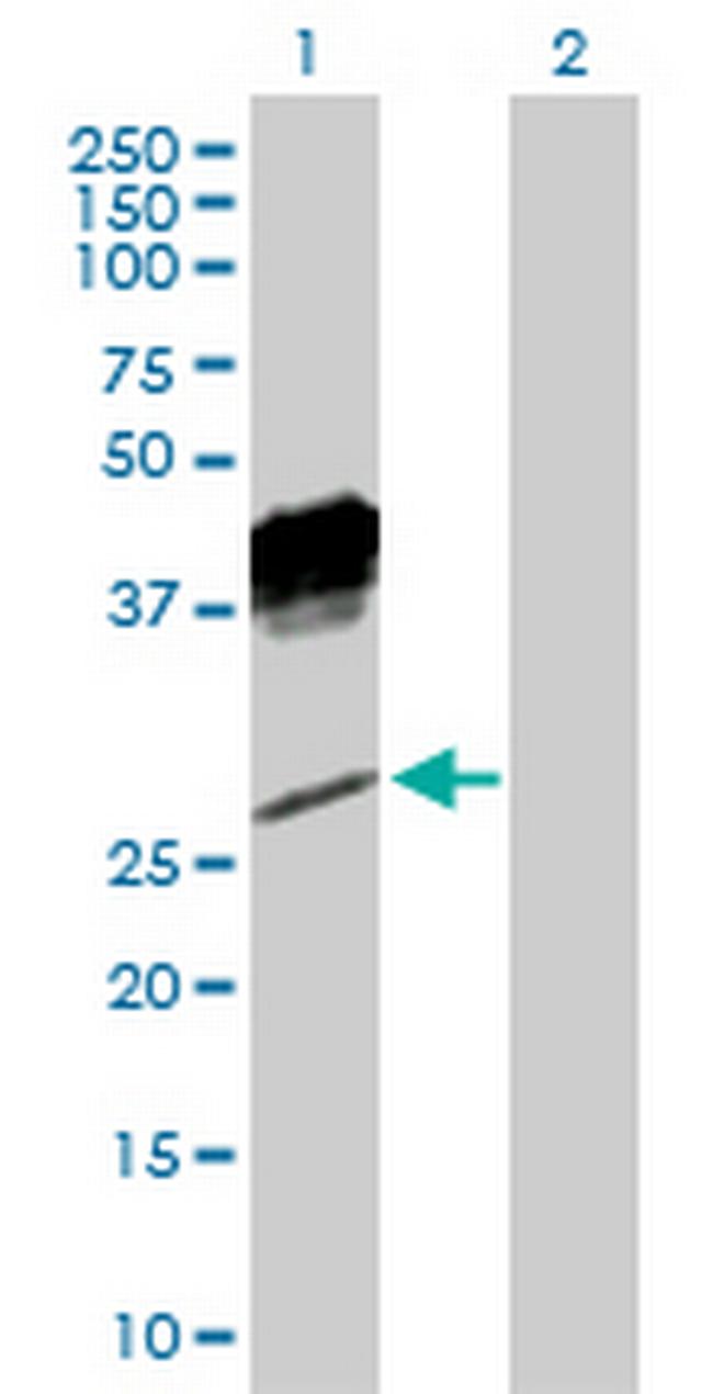 KLRC1 Antibody in Western Blot (WB)
