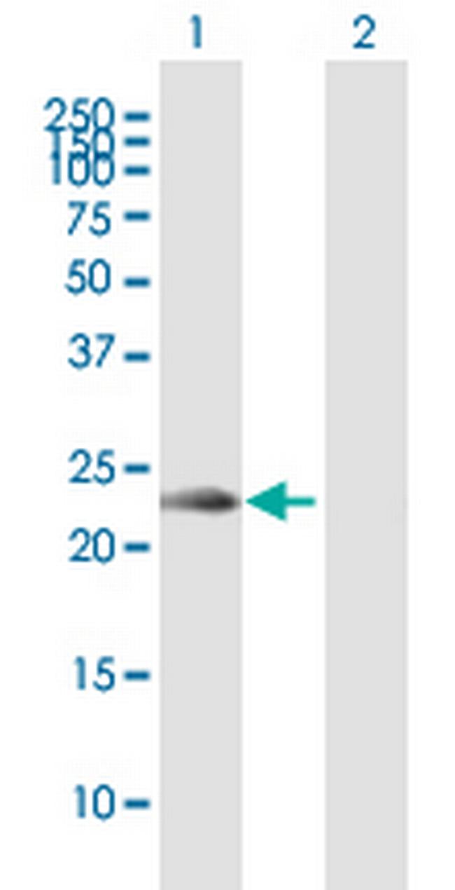 KLRC2 Antibody in Western Blot (WB)