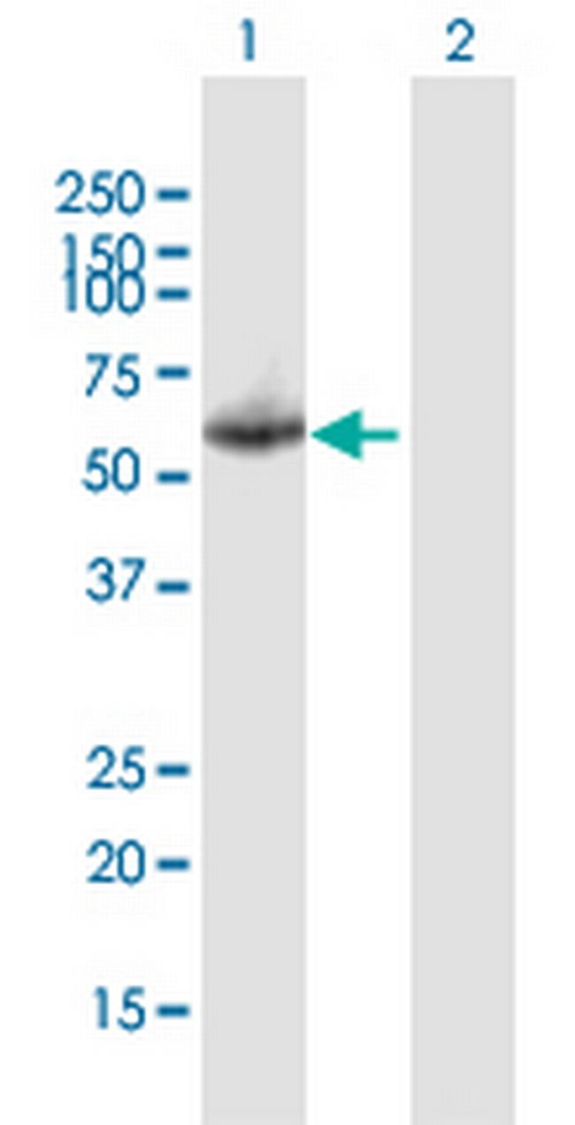 KNG1 Antibody in Western Blot (WB)