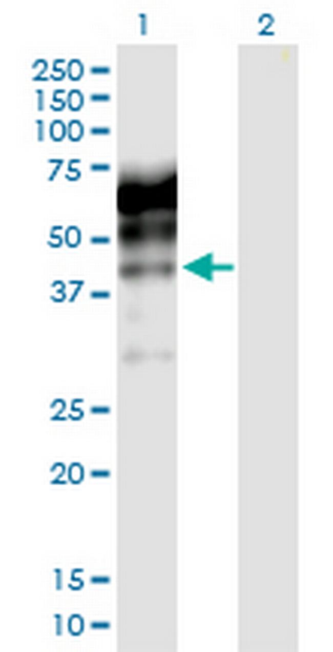 KNG1 Antibody in Western Blot (WB)