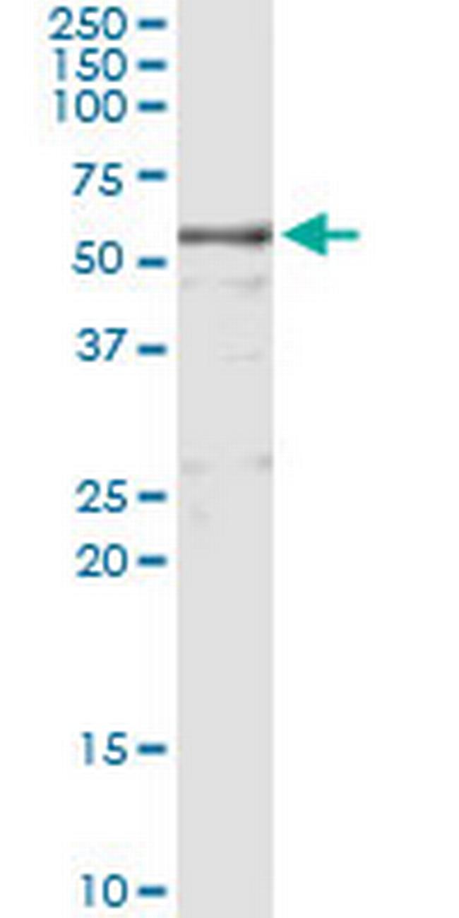 KNG1 Antibody in Immunoprecipitation (IP)