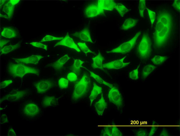 KIFC1 Antibody in Immunocytochemistry (ICC/IF)