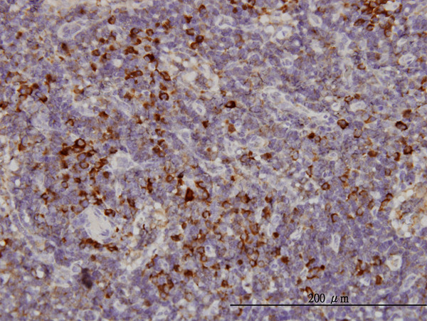 KIFC1 Antibody in Immunohistochemistry (Paraffin) (IHC (P))