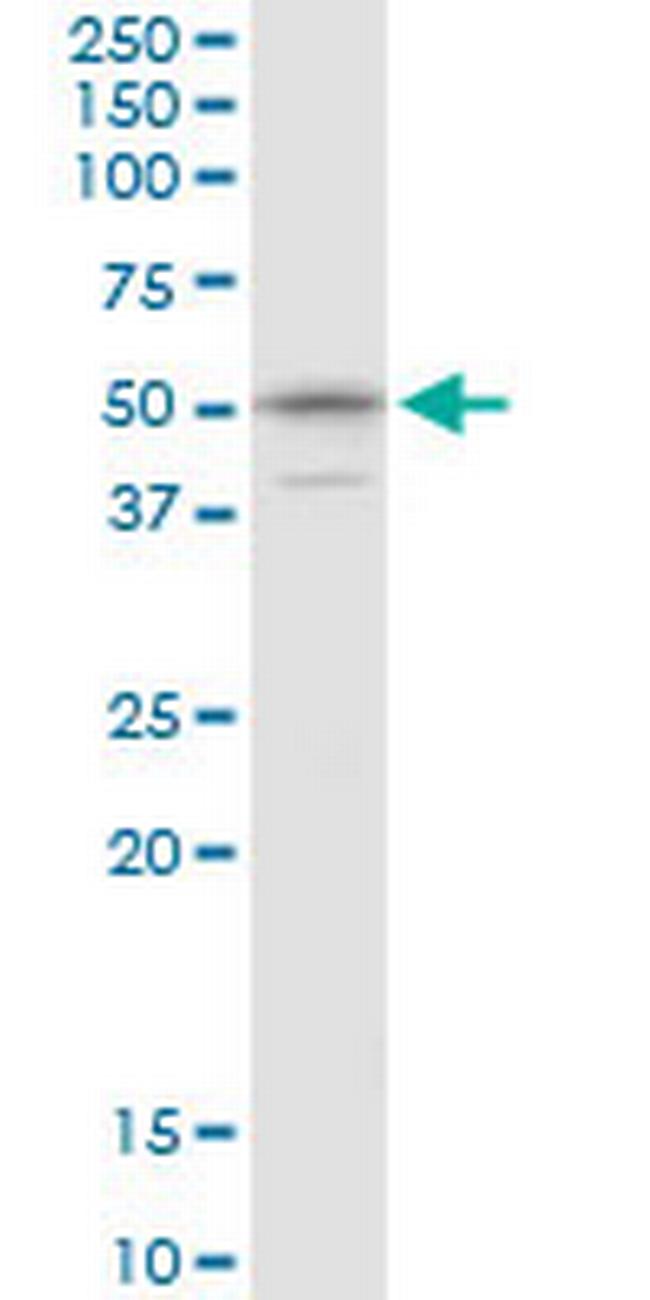 KPNA1 Antibody in Western Blot (WB)