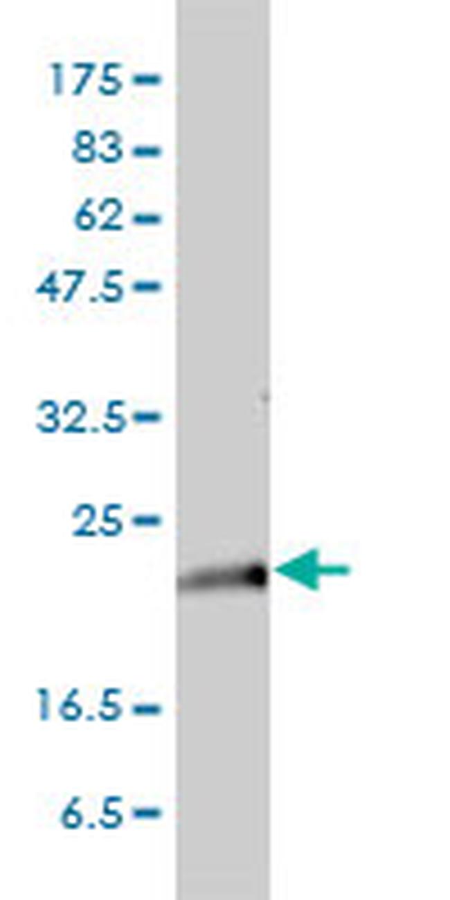 KRAS Antibody in Western Blot (WB)