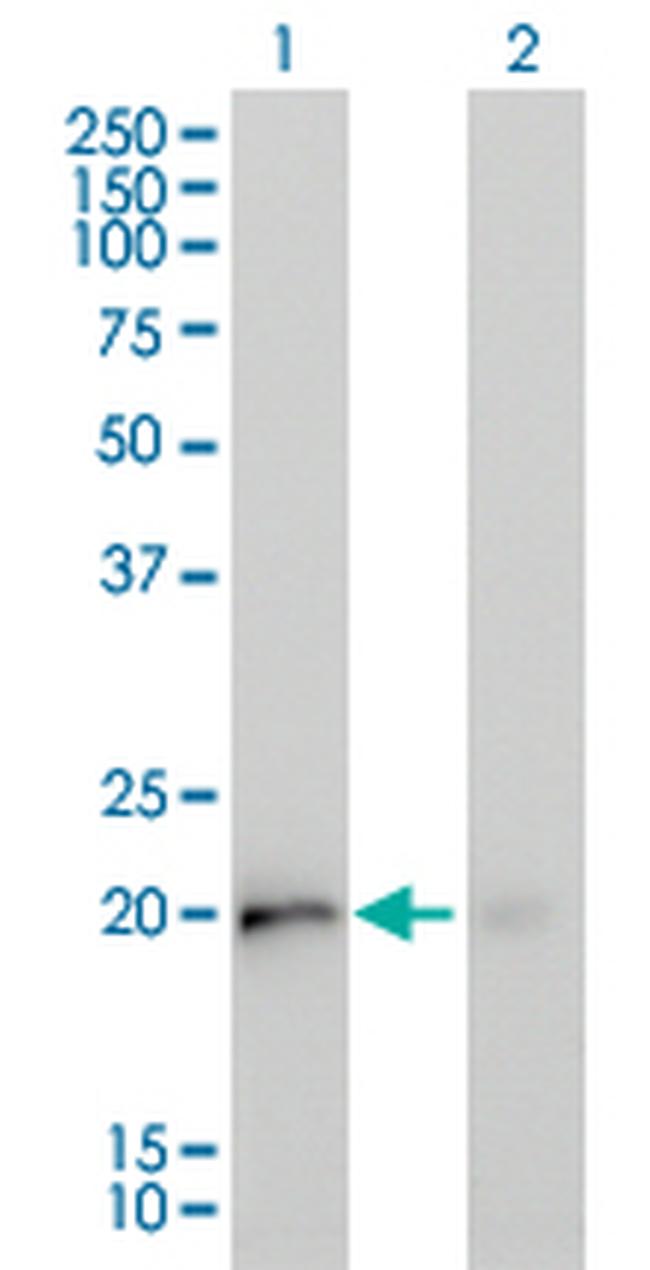 KRAS Antibody in Western Blot (WB)