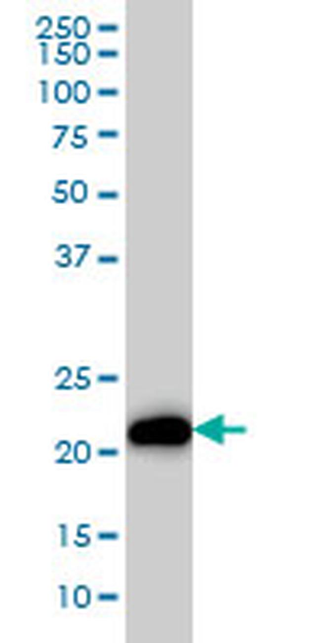 KRAS Antibody in Western Blot (WB)