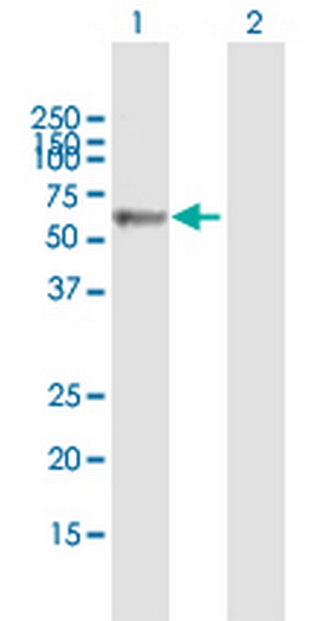 KRT4 Antibody in Western Blot (WB)