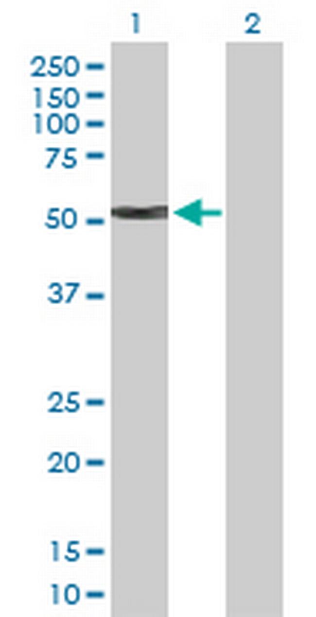 KRT4 Antibody in Western Blot (WB)