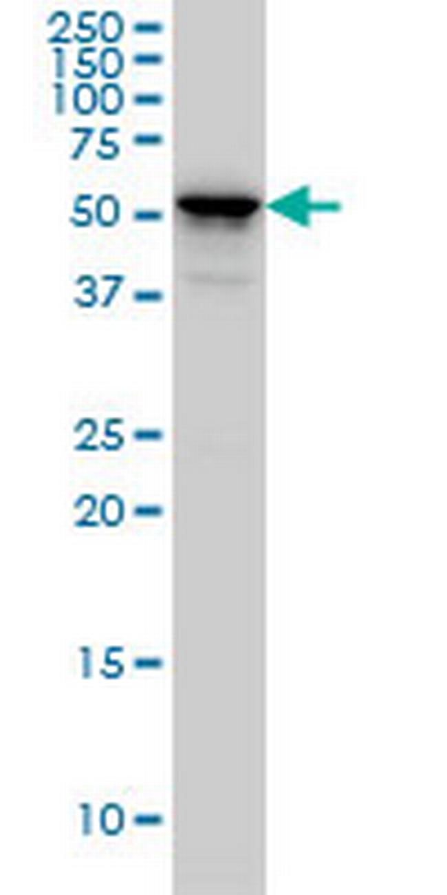 KRT4 Antibody in Western Blot (WB)