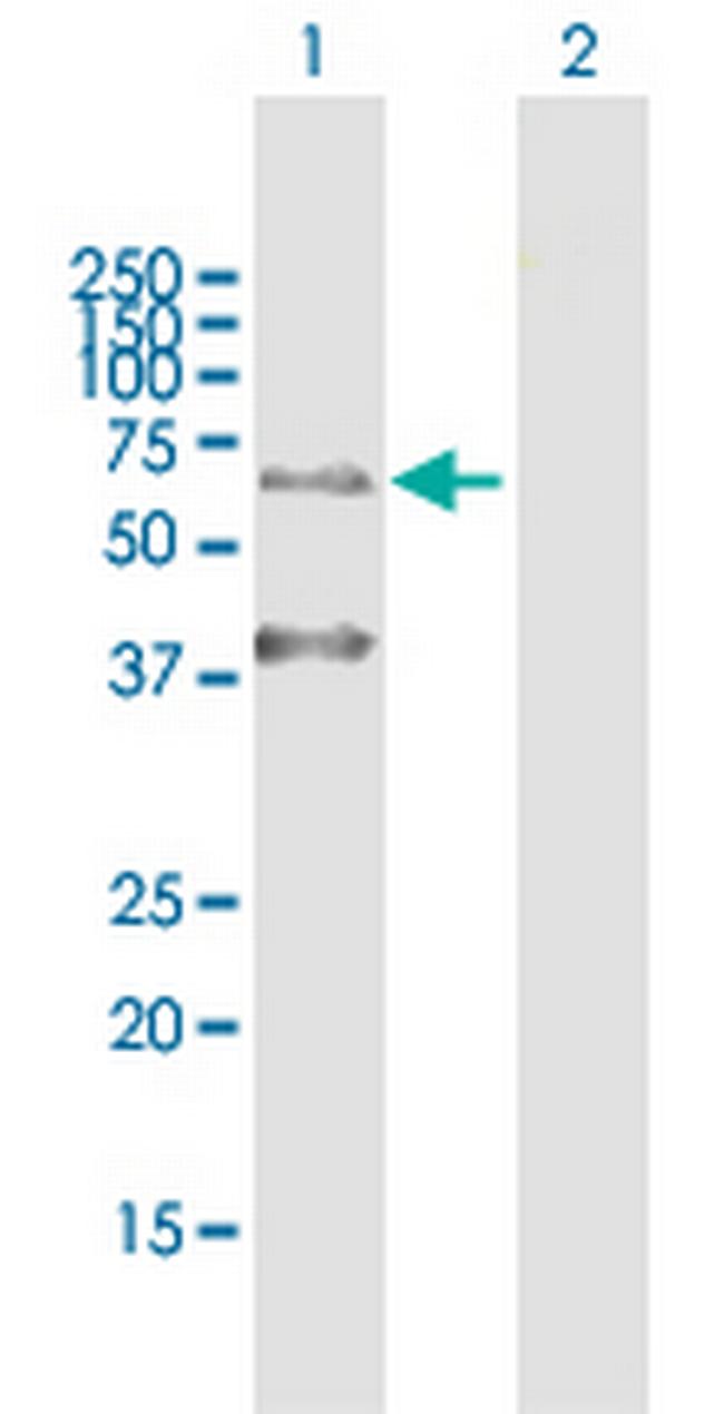 KRT9 Antibody in Western Blot (WB)