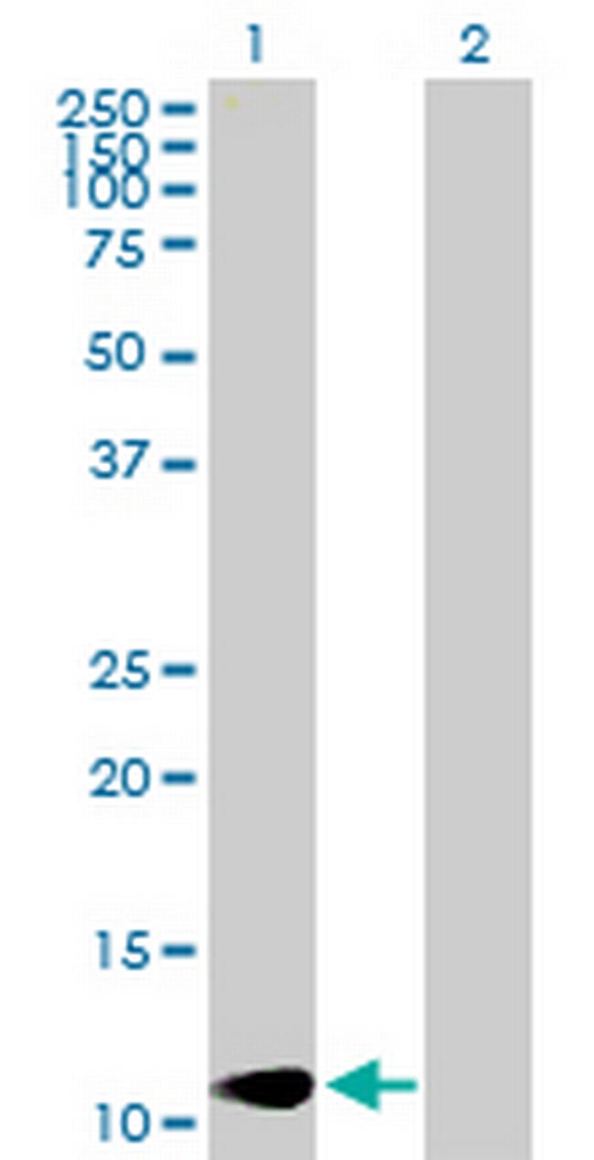 LAMA4 Antibody in Western Blot (WB)