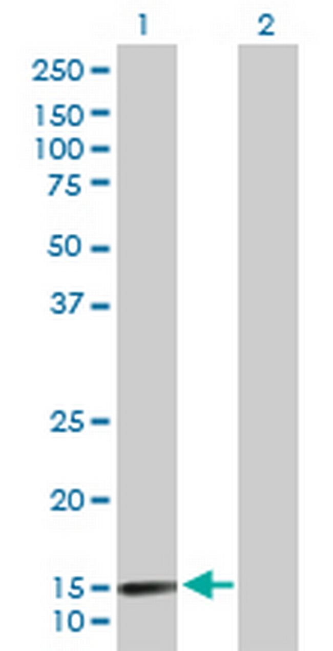 LAMA4 Antibody in Western Blot (WB)