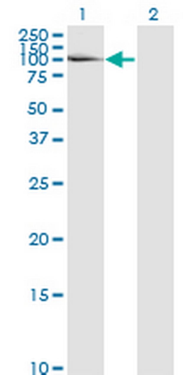 LAMA5 Antibody in Western Blot (WB)