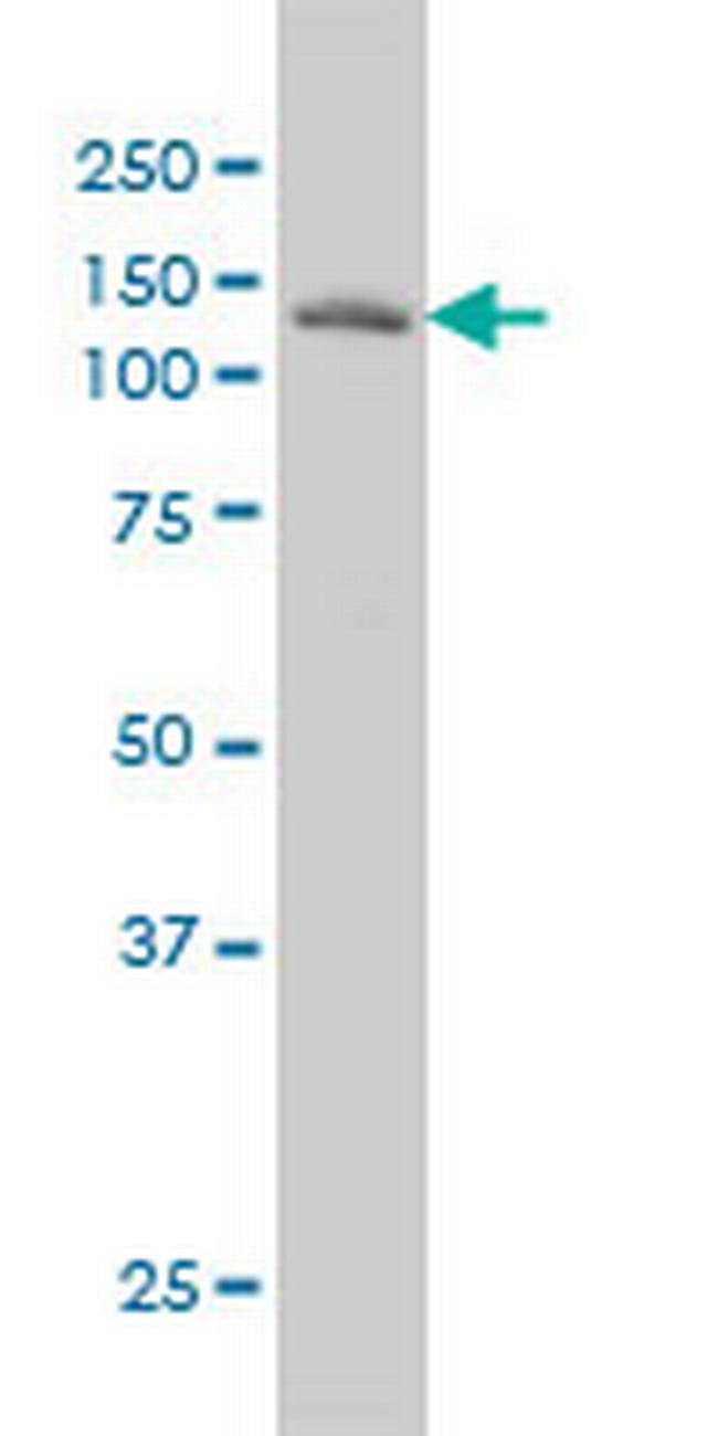 LAMB3 Antibody in Western Blot (WB)