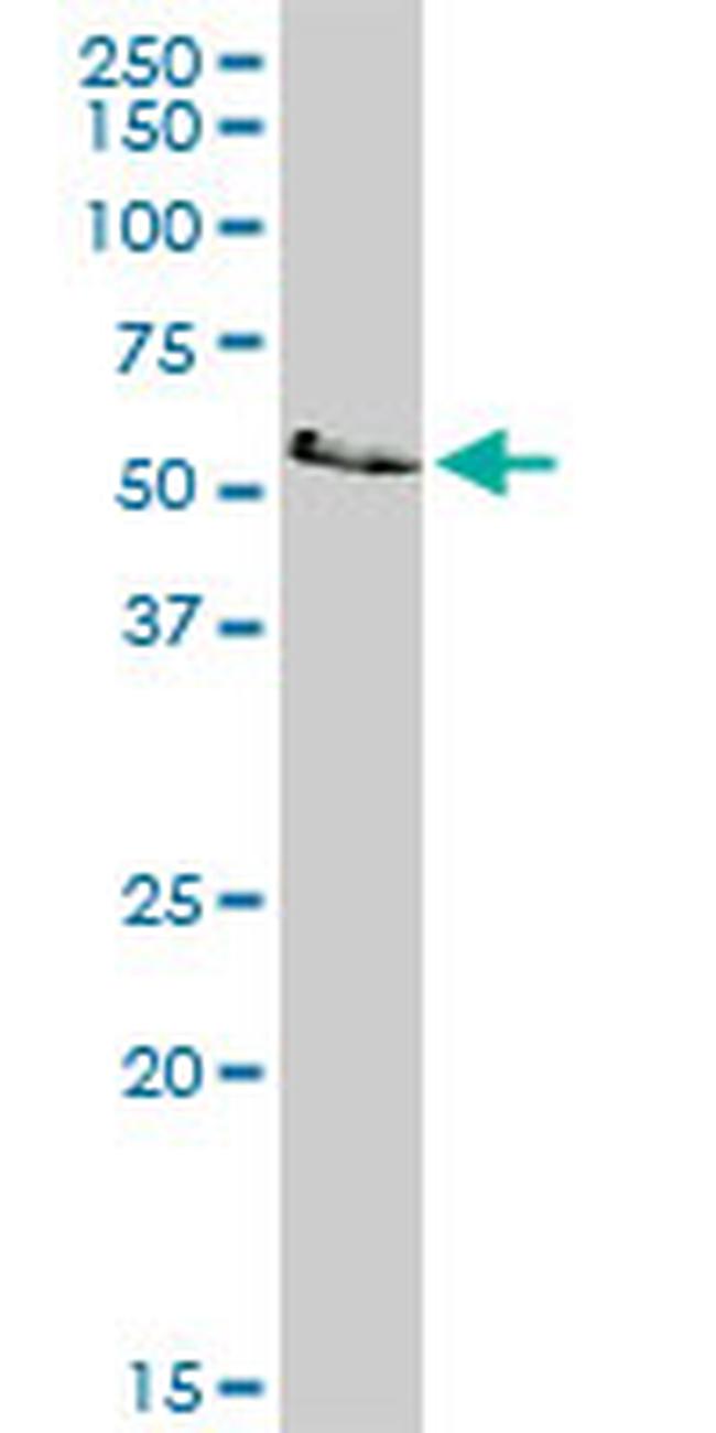 LCK Antibody in Western Blot (WB)