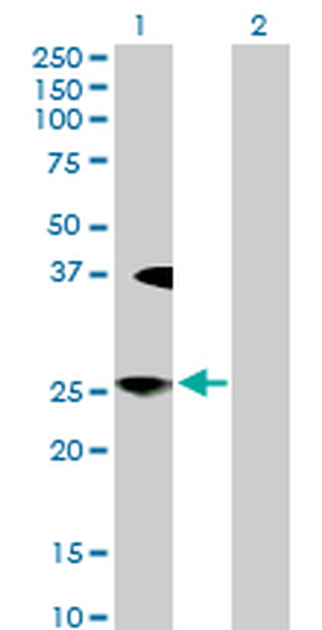 LFNG Antibody in Western Blot (WB)