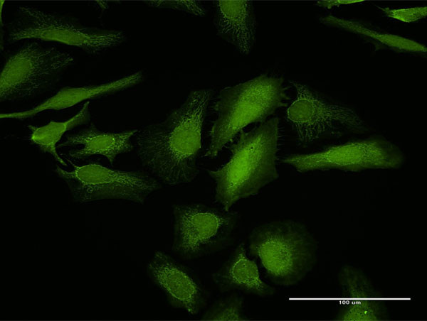 LGALS1 Antibody in Immunocytochemistry (ICC/IF)