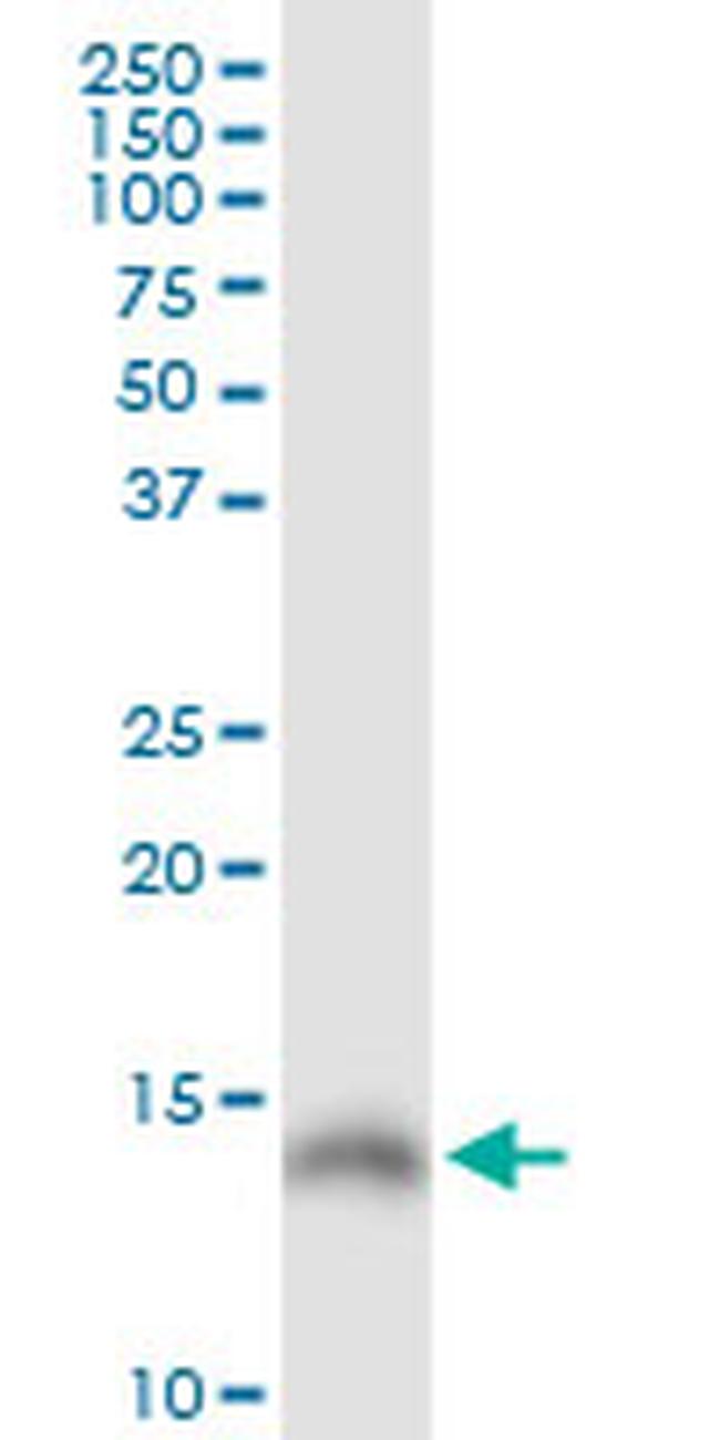 LGALS1 Antibody in Western Blot (WB)