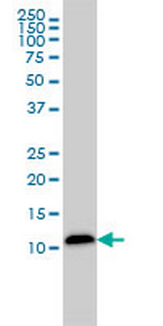 LGALS1 Antibody in Western Blot (WB)