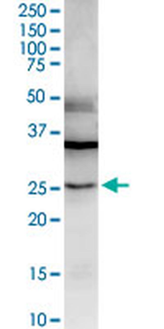 LGALS3 Antibody in Western Blot (WB)