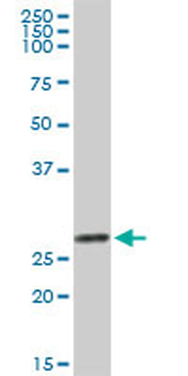 LGALS3 Antibody in Western Blot (WB)