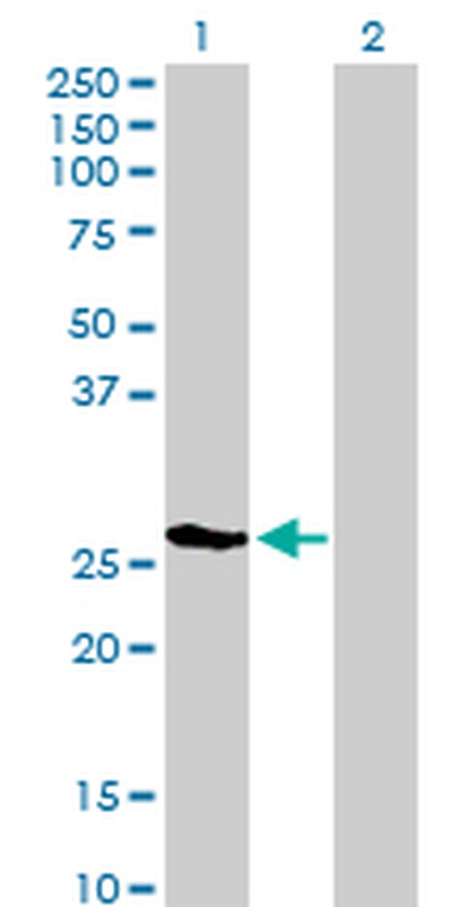 LGALS3 Antibody in Western Blot (WB)