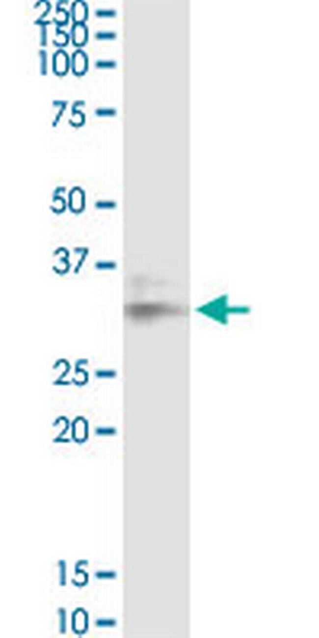 LGALS8 Antibody in Western Blot (WB)