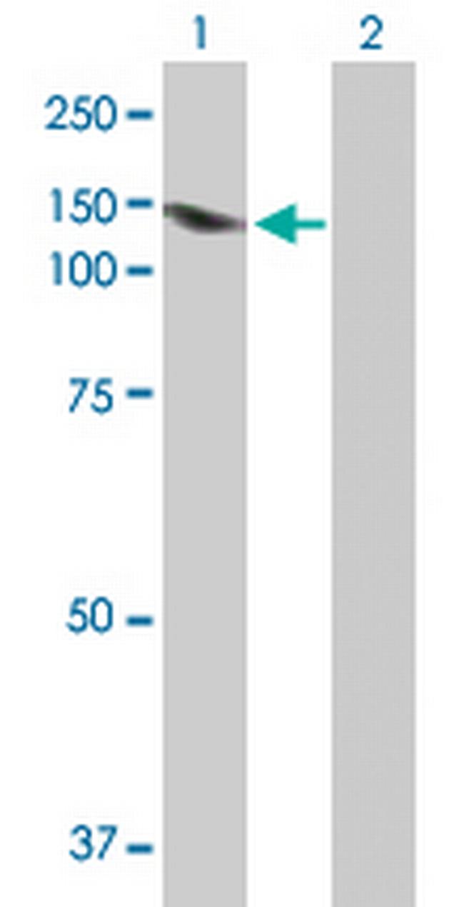 LIG1 Antibody in Western Blot (WB)