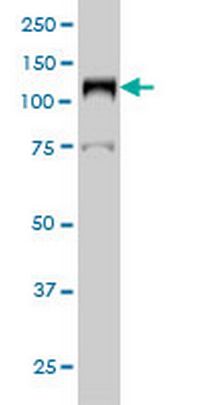 LIG1 Antibody in Western Blot (WB)