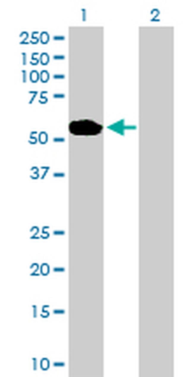 ABLIM1 Antibody in Western Blot (WB)