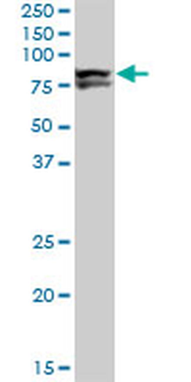 LIMK1 Antibody in Western Blot (WB)