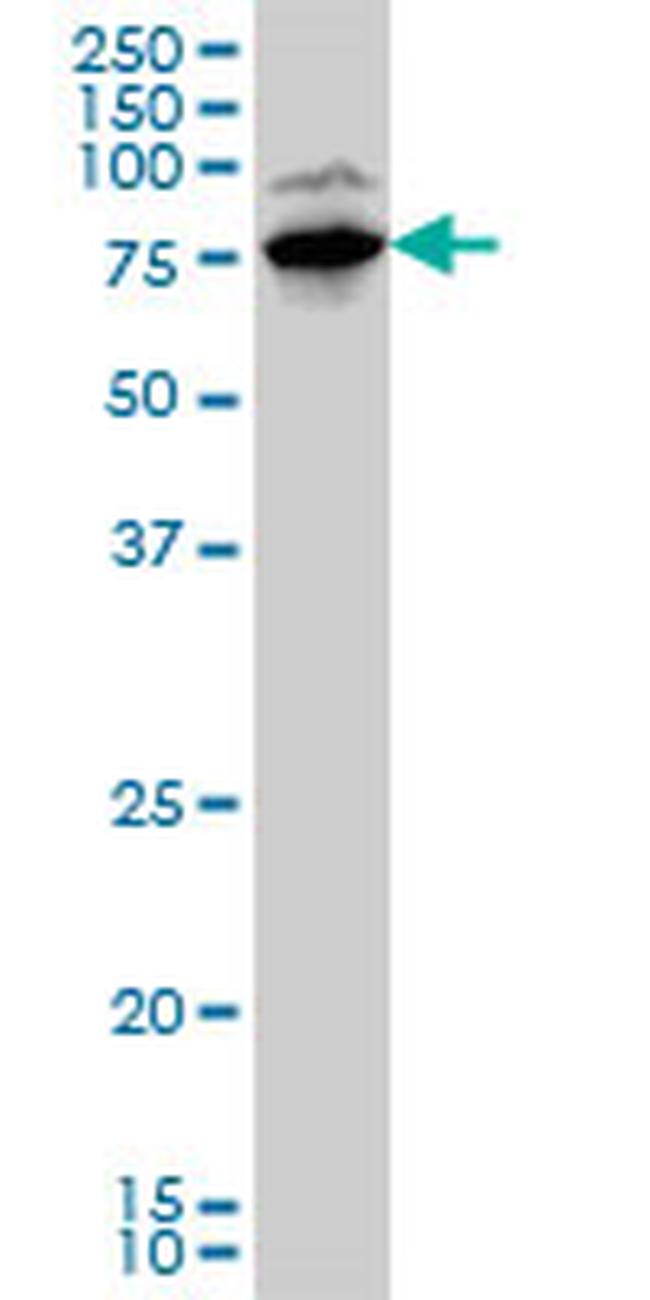 LIMK1 Antibody in Western Blot (WB)