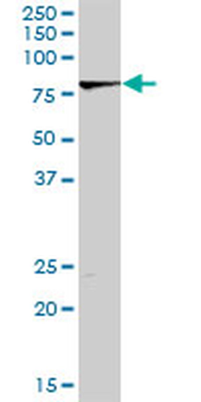 LIMK2 Antibody in Western Blot (WB)