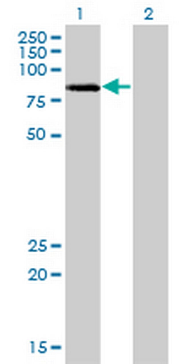 LIMK2 Antibody in Western Blot (WB)