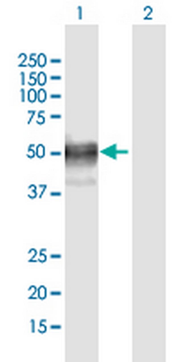 LIPA Antibody in Western Blot (WB)