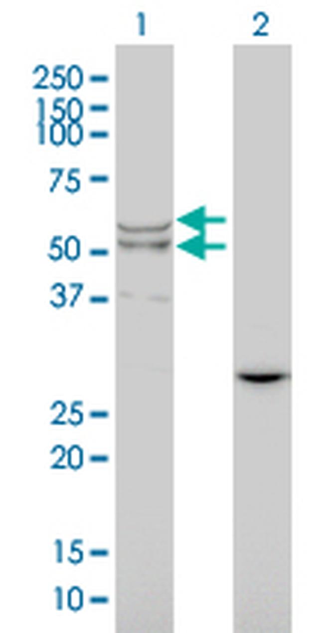 LIPA Antibody in Western Blot (WB)