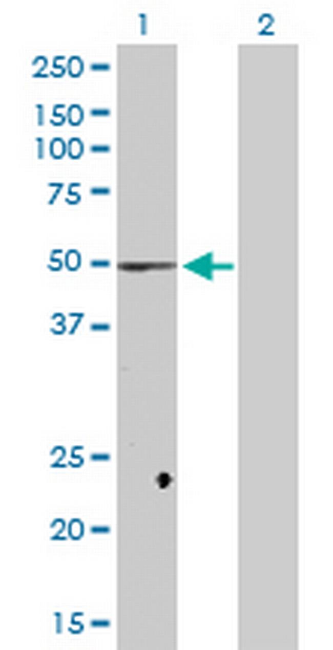 FADS1 Antibody in Western Blot (WB)