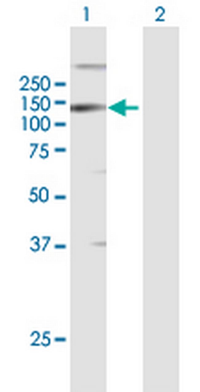 LLGL2 Antibody in Western Blot (WB)