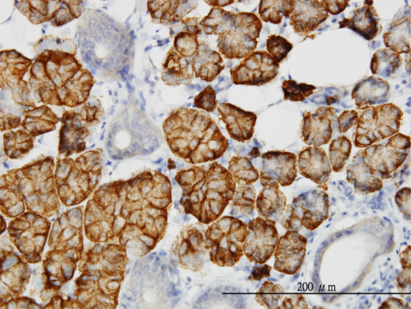 LLGL2 Antibody in Immunohistochemistry (Paraffin) (IHC (P))