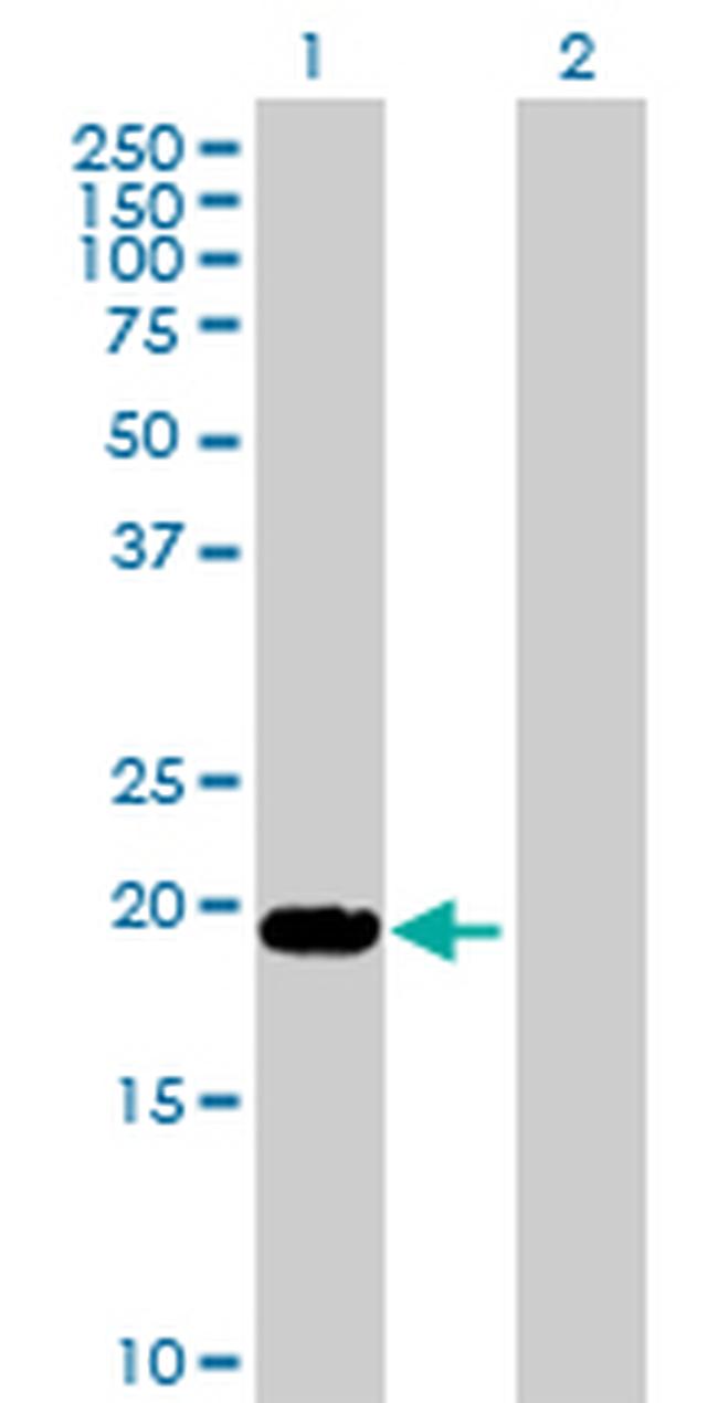 LTA Antibody in Western Blot (WB)