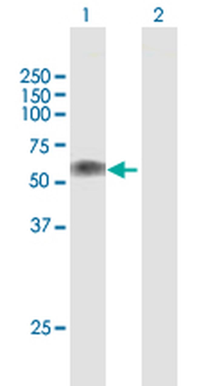 LTBR Antibody in Western Blot (WB)